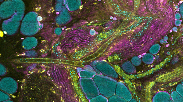 extracellular vesicle