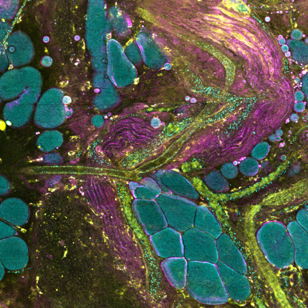 Extracellular vesicle