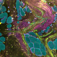 Extracellular vesicle