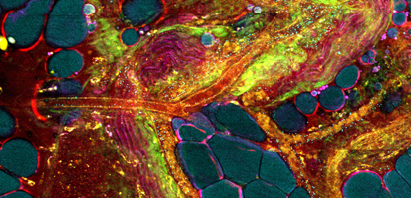 Scientific image of extracellular vesicles