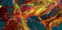 Scientific image of extracellular vesicles